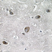Anti-LYS5 Antibody