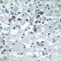 Anti-KDELR3 Antibody
