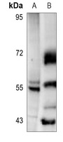 Fibulin 3 Antibody