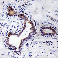 Anti-Fibulin 3 Antibody