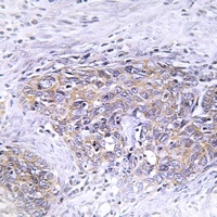 Anti-CLN6 Antibody