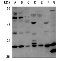 Carbonic Anhydrase 5B Antibody