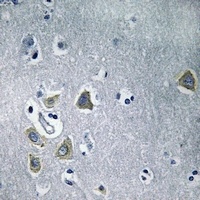 Carbonic Anhydrase 5B Antibody