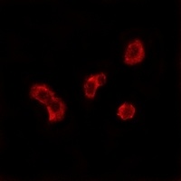 Carbonic Anhydrase 5B Antibody