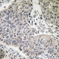 Anti-BRP44 Antibody