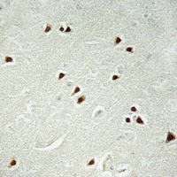 Anti-DDX51 Antibody