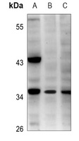 ATP12 Rabbit Polyclonal Antibody