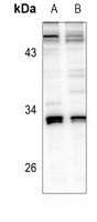 AIG1 Antibody