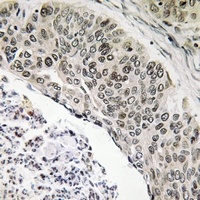 Anti-ALS2CR8 Antibody