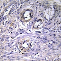 Anti-ABHD12 Antibody