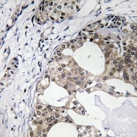 Anti-RPS25 Antibody