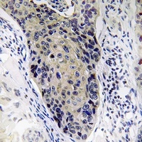 Anti-MRPL34 Antibody