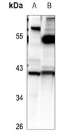 LPAAT epsilon Rabbit Polyclonal Antibody