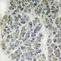 Anti-CARD10 Antibody