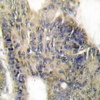 Anti-p220 Antibody