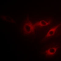 Anti-p220 Antibody