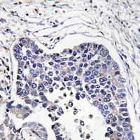 Anti-AIFM2 Antibody