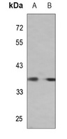 CDC50B Rabbit Polyclonal Antibody