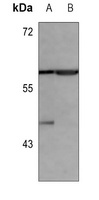Cytochrome P450 1A2 Antibody