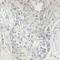 Cytochrome P450 1A2 Antibody