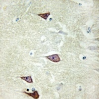 Anti-Collagen 25 alpha 1 Antibody