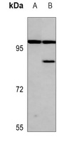 AKAP 2 Rabbit Polyclonal Antibody