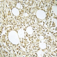 DNA Polymerase lambda Antibody