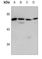 HSFX1 Antibody