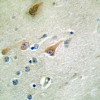Anti-NT5C3 Antibody