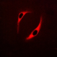 NT5C3 antibody