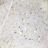 Anti-PGBD1 Antibody