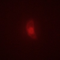 Anti-BRSK1 Antibody