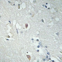 Anti-LDOC1L Antibody