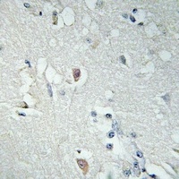 LDOC1L antibody