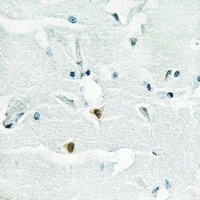 Shugoshin 1 antibody
