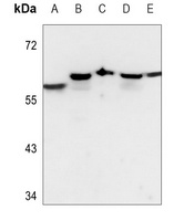 DAK Rabbit Polyclonal Antibody