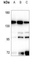 DGK delta Rabbit Polyclonal Antibody