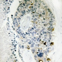 DGK delta Rabbit Polyclonal Antibody