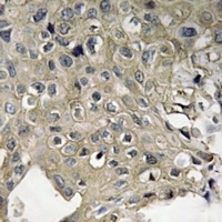 Anti-Enterokinase Antibody