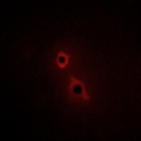 Anti-Enterokinase Antibody