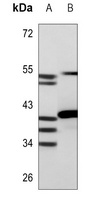 HOXA1/B1/D1 Antibody
