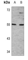 IRF3 Rabbit Polyclonal Antibody