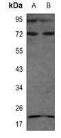 S6K1 Antibody