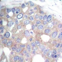 S6K1 Antibody