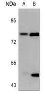 PKC gamma (Phospho-T655) Antibody