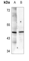 SGK1 (Phospho-T256) Antibody