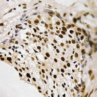 PRAK (Phospho-T182) Antibody