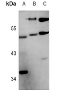 FOXO4 (Phospho-S262) Rabbit Polyclonal Antibody