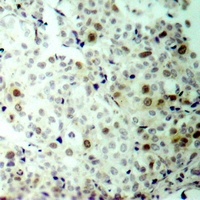 CDK2 (phospho-T160) antibody