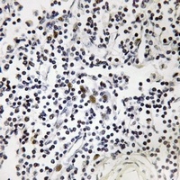 Anti-OCT1 (Phospho-S385) Antibody